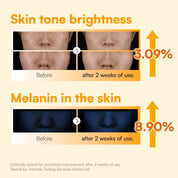Face Republic - Vita Radiance Niacin 10 Cream - Mr.PMU